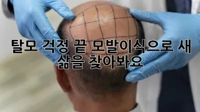 탈모 걱정 끝! 모발이식으로 새 삶을 찾아봐요! ✨
